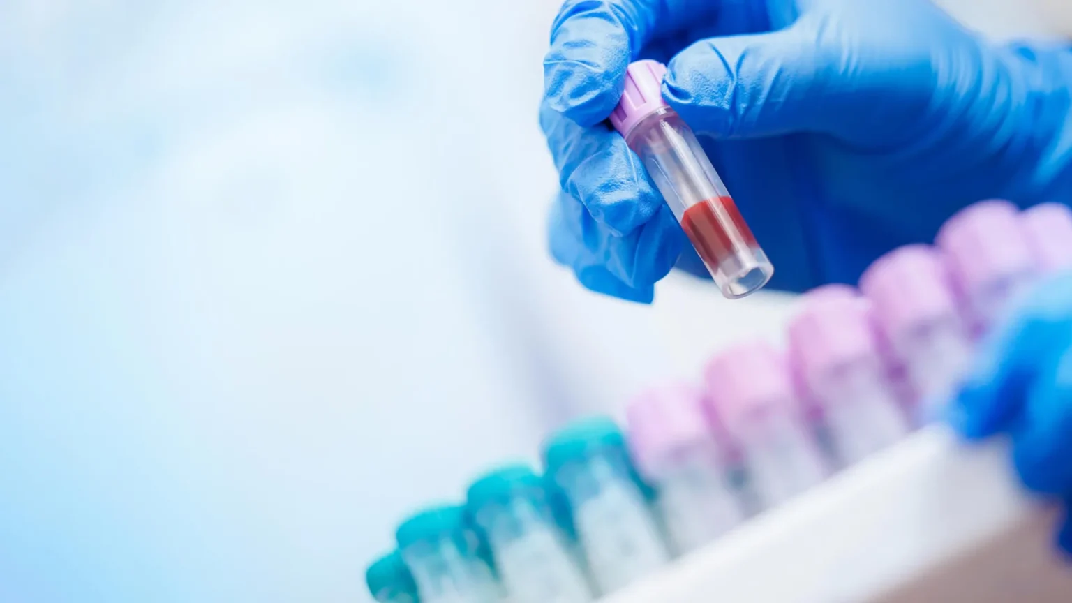 Avanço da IA revela insights que salvam vidas em exames de sangue do dia a dia Avanço da IA revela insights que salvam vidas em exames de sangue do dia a dia